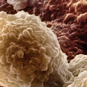 Prueba Marcadores Inflamatorios (Infecciones, lesiones o enfermedades)