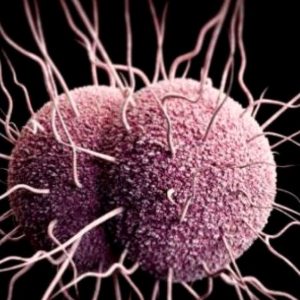 Prueba Serología enfermedad sexual (VIH, Hepatitis, Sífilis)