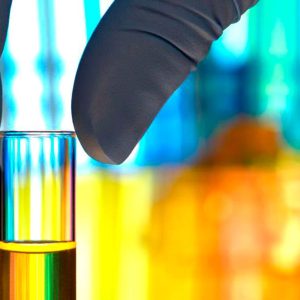 Prueba Alergia Metales
