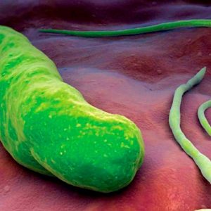 Prueba Helicobacter pylori (Dolor de estómago, hinchazón, náuseas)