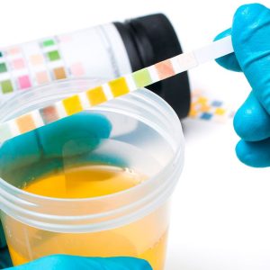 Prueba Infección urinaria (Test Orina)
